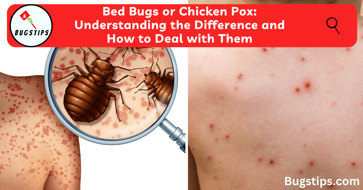 Bed Bugs or Chicken pox