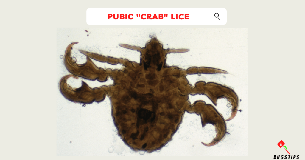  Pubic "Crab" Lice