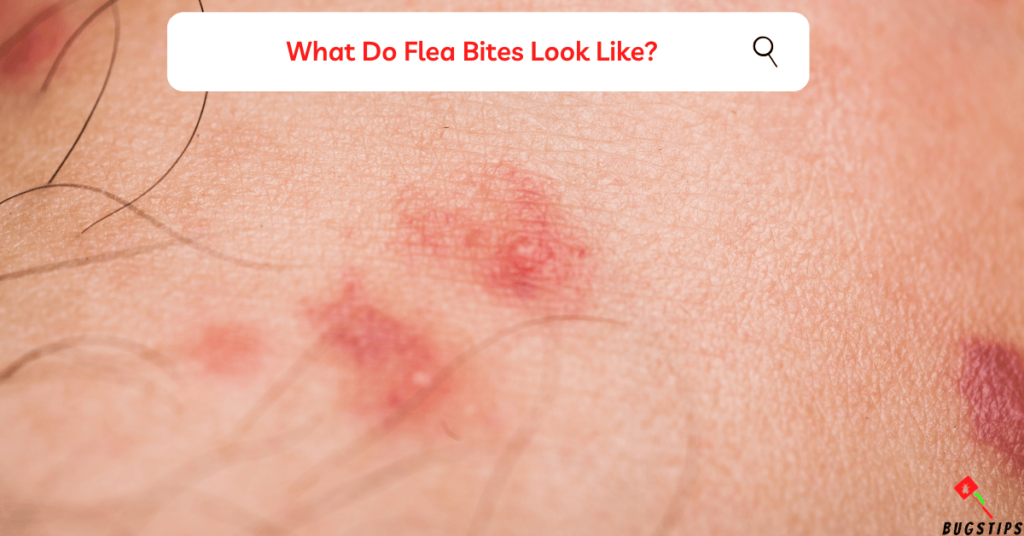 What Do Flea Bites Look Like?
